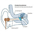 CROSSCALL - Ecouteurs X-Vibes CROSSCALL casque à conduction osseuse - 1304069999572 - vignette