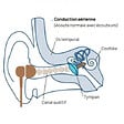 CROSSCALL - Ecouteurs X-Vibes CROSSCALL casque à conduction osseuse - 1304069999572 - vignette