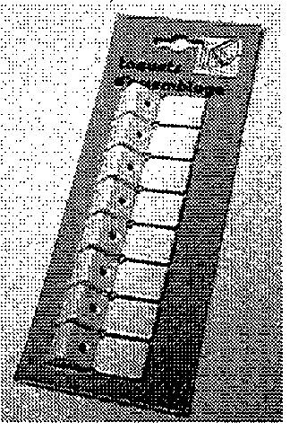 SPTD - Taquets blanc x8 - large